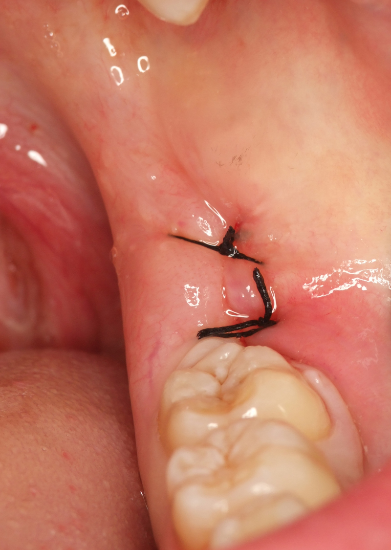 コラム 神田の歯医者 神田デンタルケアクリニック Part 2