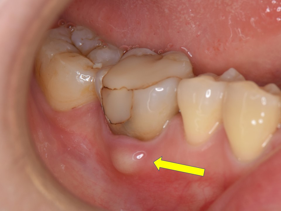 口腔の健康状態
